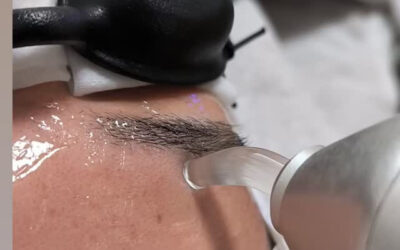 ✨男性眉毛脱毛✨