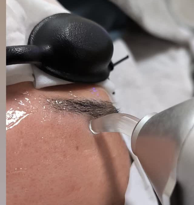 ✨男性眉毛脱毛✨